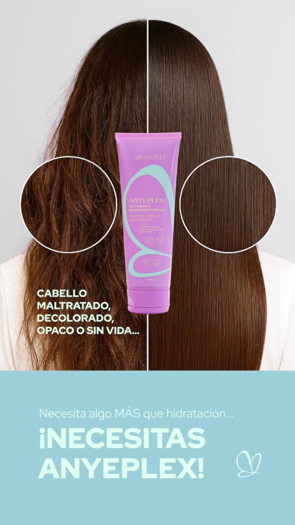 Anyeplex Profesional Anyeluz - Imagen 2