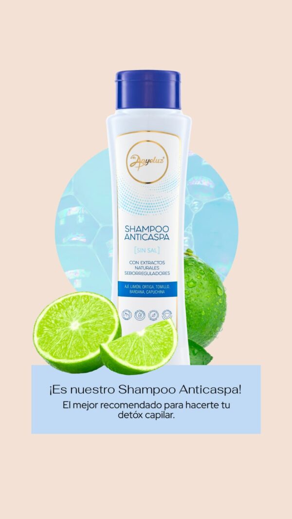 Shampoo Anticaspa Anyeluz - Imagen 2